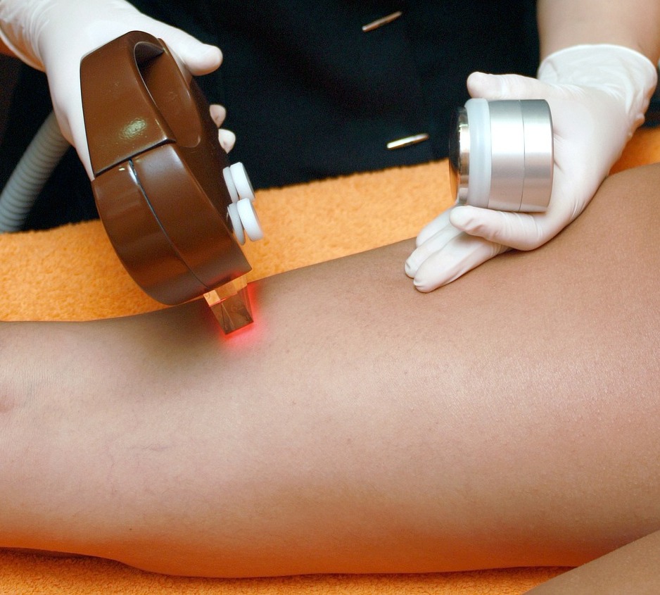 Electrolysis Hair Removal: A Smooth Solution for Men
